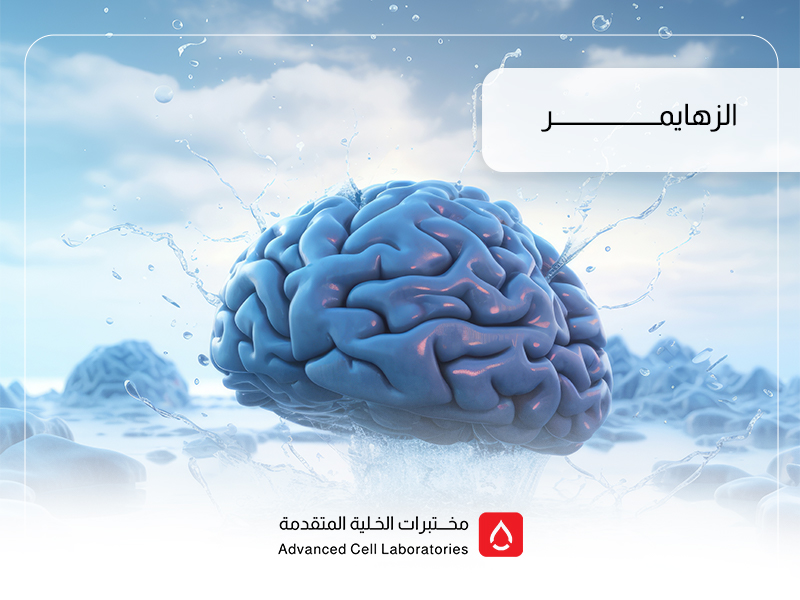 مرض الزهايمر