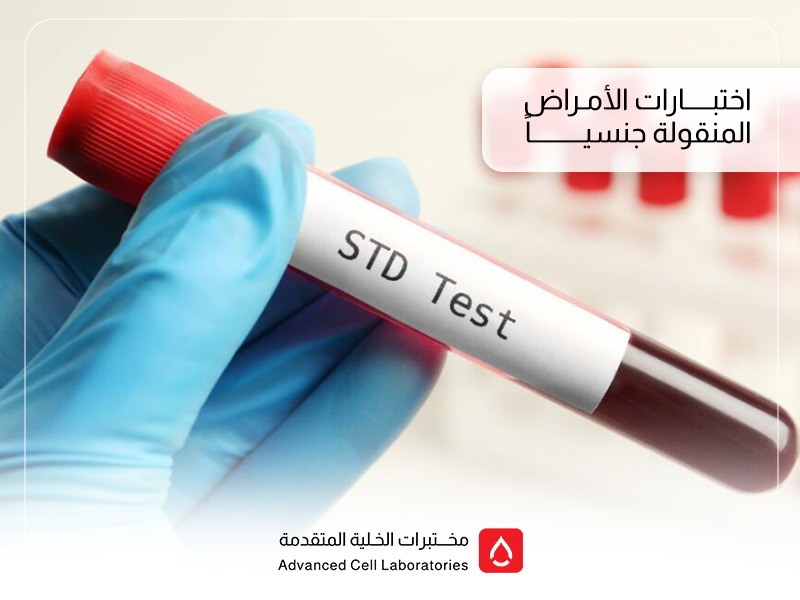تحاليل الأمراض المنقولة جنسياً في السعودية