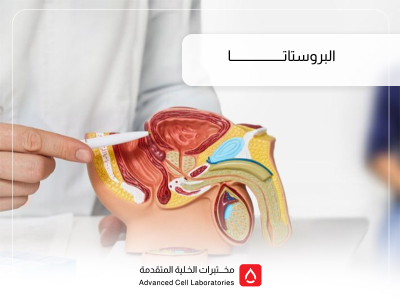 فحص البروستاتا