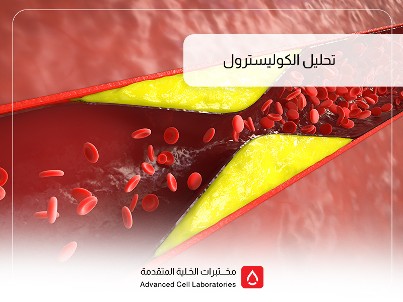 تحاليل الكوليسترول في الدم: دليلك الشامل لفحص الدهون في السعودية