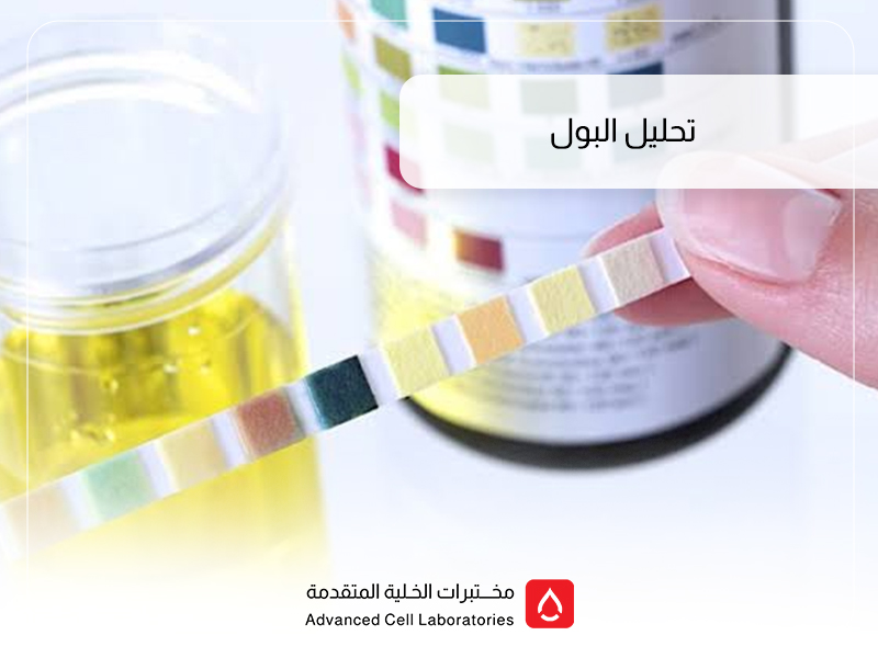 تحليل البول: دليل شامل لفهم نتائجه وأهميته