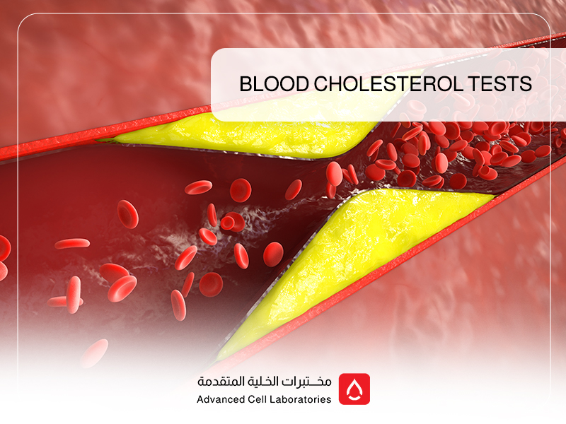 Blood Cholesterol Tests