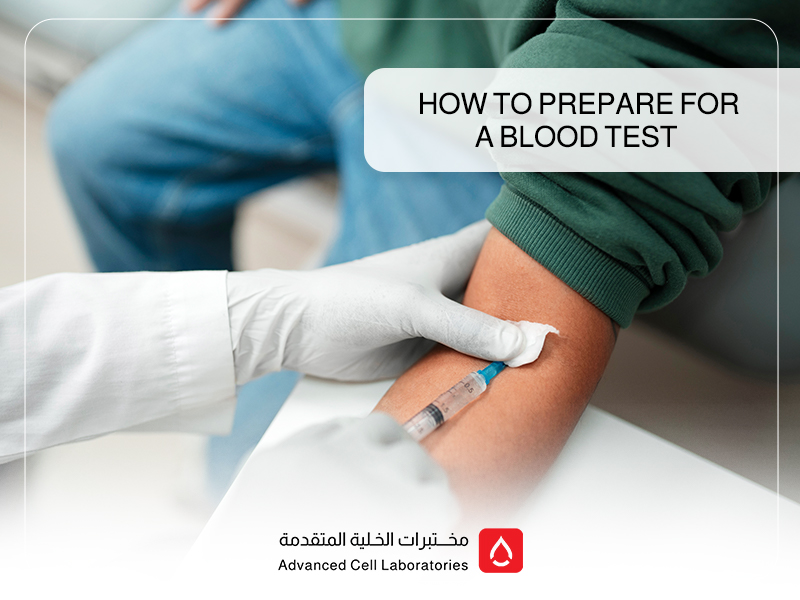 How to Prepare for a Blood Test