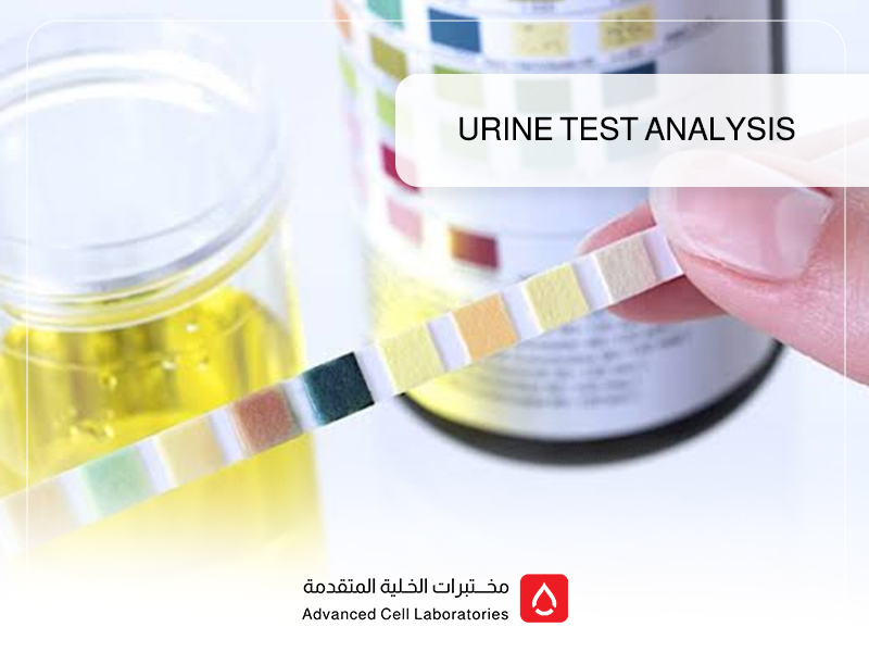 Urine Test Analysis